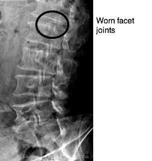 Femoral nerve casefile has severe pain in the front of the thigh.